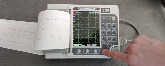 Около трех тысяч жителей Карачаево-Черкесии опробовали новое оборудование для диагностики сердца