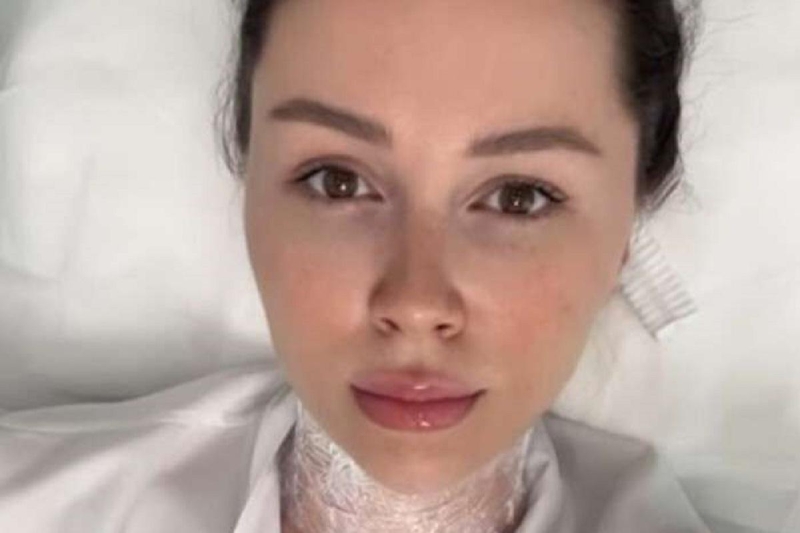 Анна Заворотнюк испугала поклонников снимком из косметологической клиники