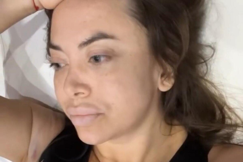 В Москве экстренно прооперировали сестру Жанны Фриске Наталью